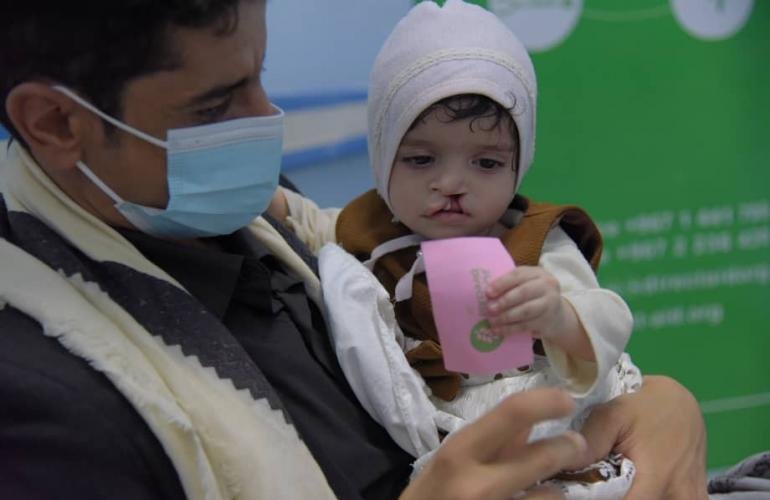 العون المباشر تدشن مخيماً طبياً لإجراء (100) عملية جراحية في صنعاء